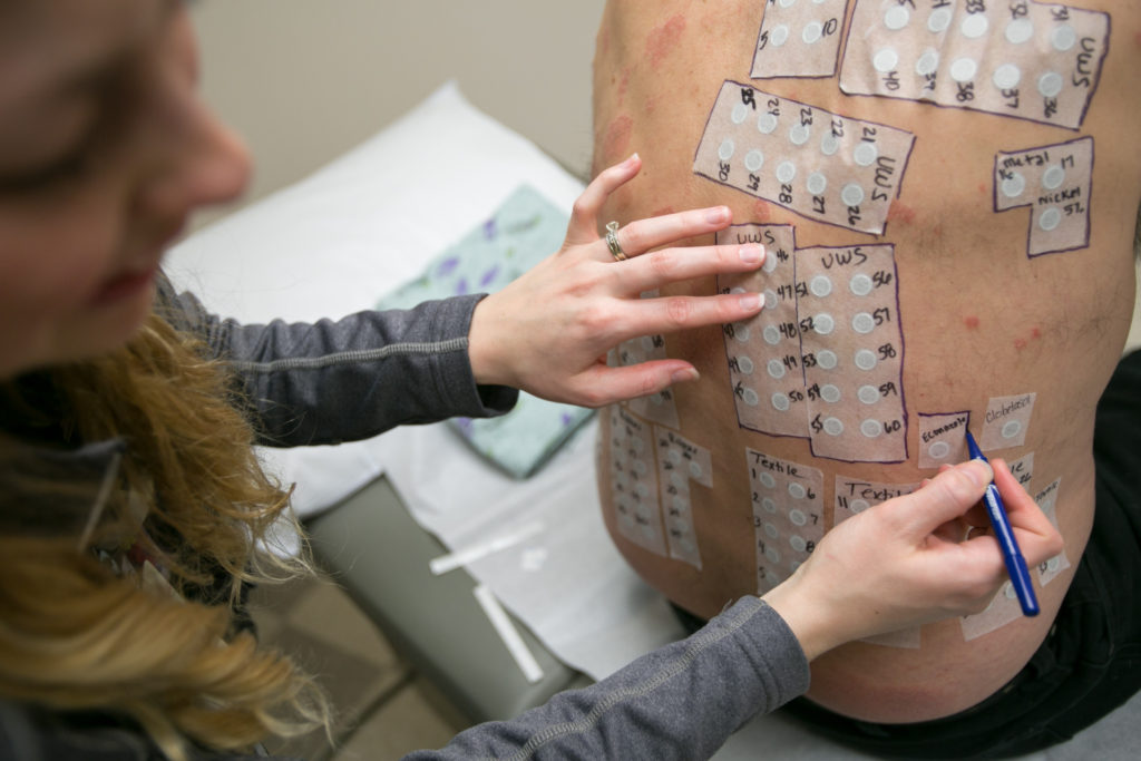 image of patch testing