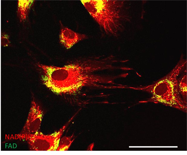 image of nad cell