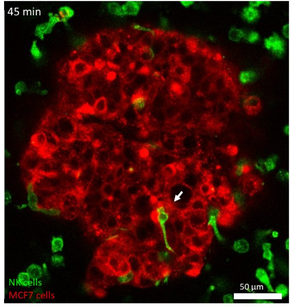 image of nk cell